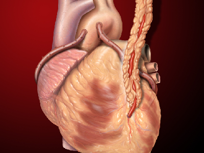 Heart Bypass Surgery In Brazil